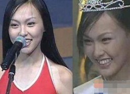 龅牙娱乐吃瓜,揭秘娱乐圈吃瓜背后的真相与笑料